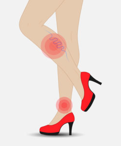 Slender female legs in red shoes with varicose veins and pain in the legs.