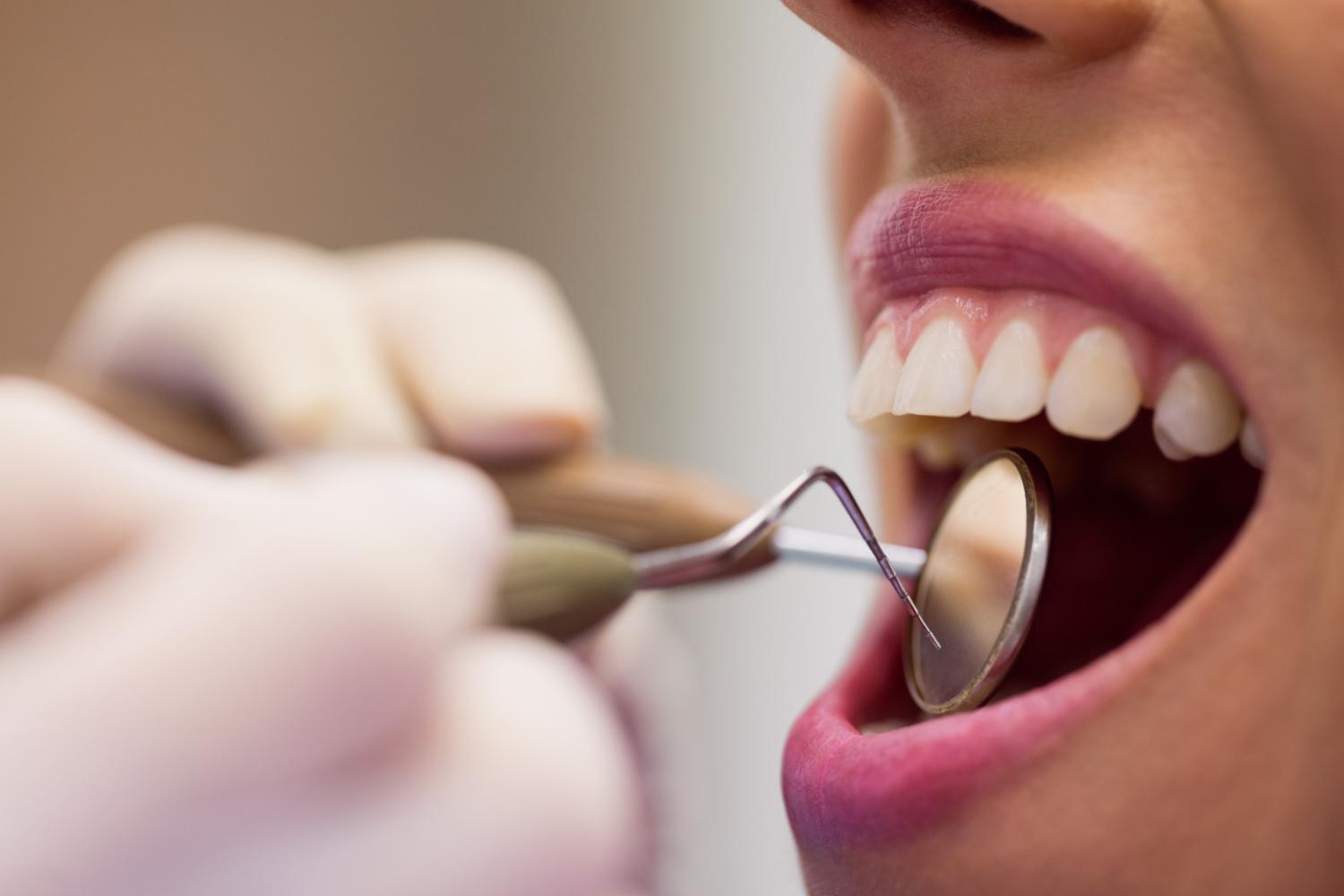 stomatolog podczas badania jamy ustnej