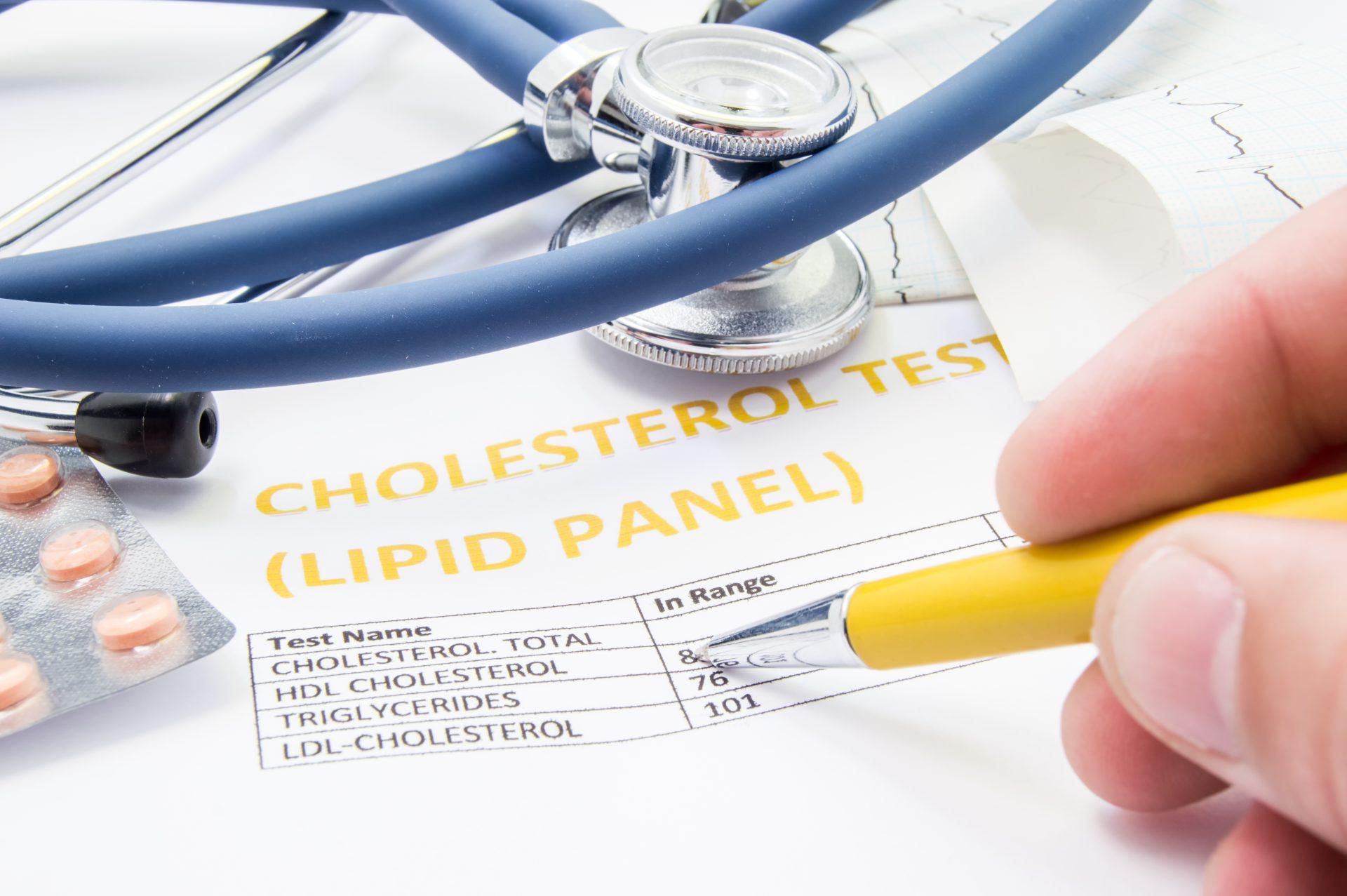 Kiedy powinieneś zacząć kontrolować poziom cholesterolu? Najnowsze zalecenia