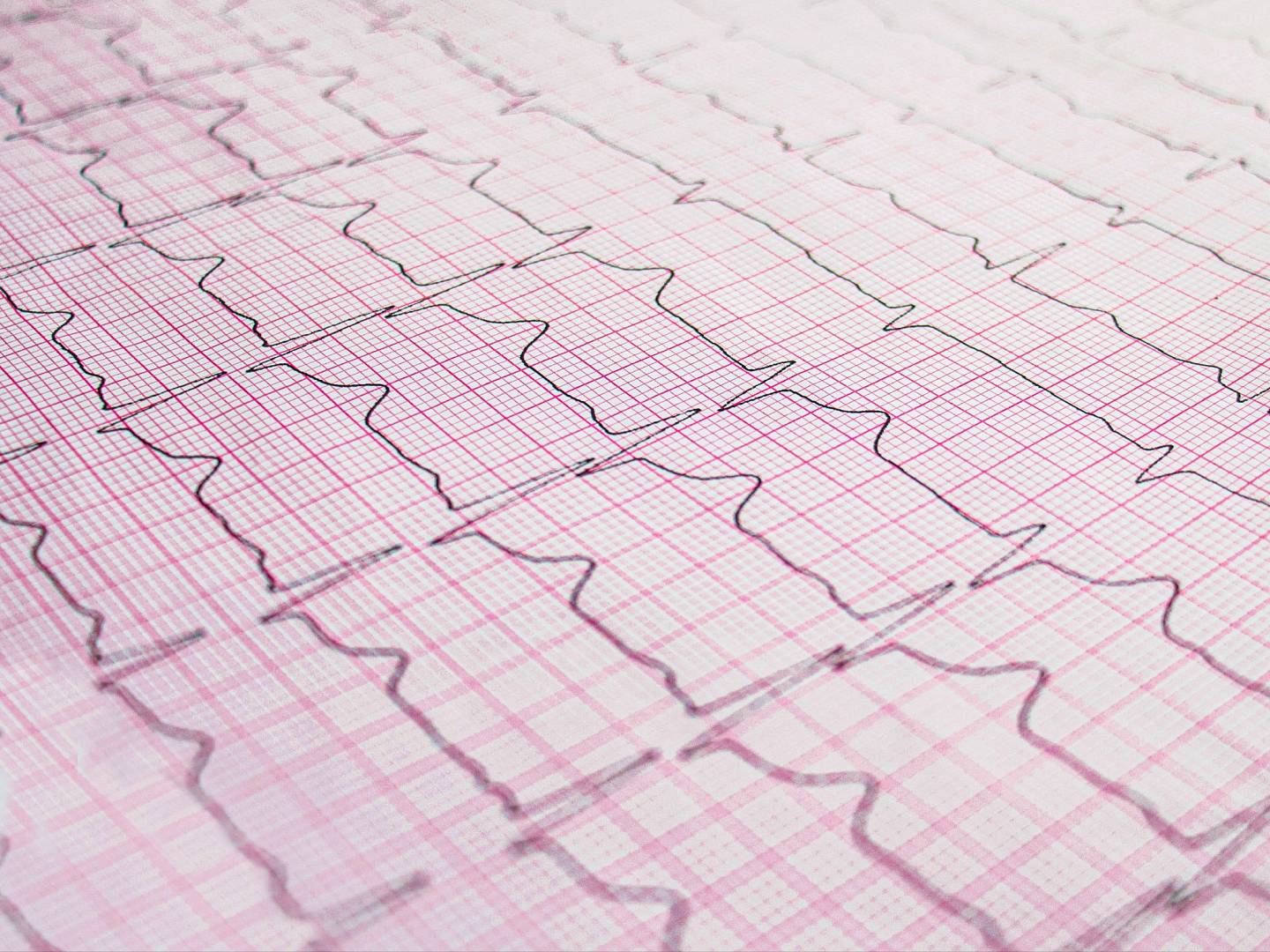 wykres EKG