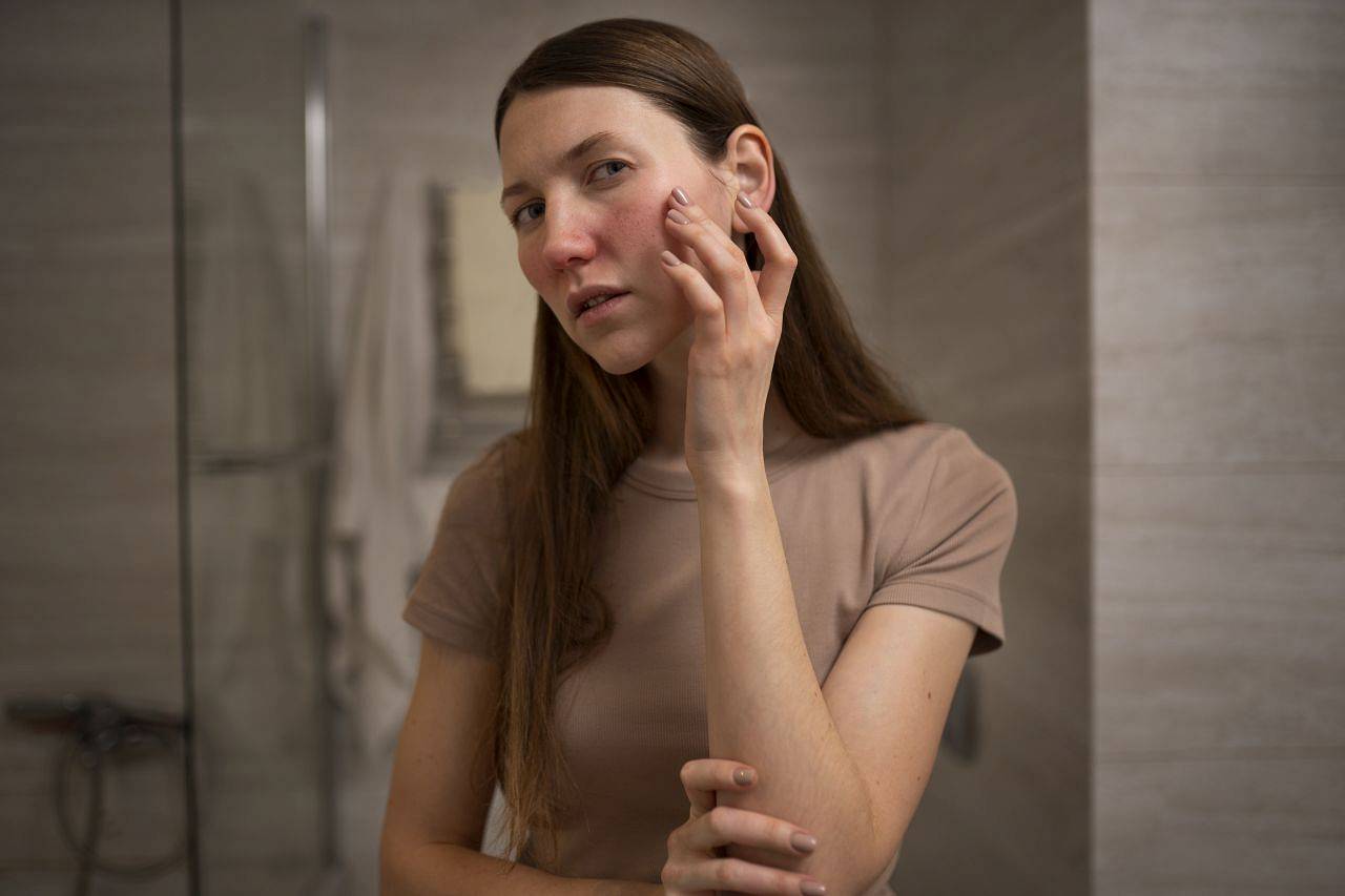 woman dealing with rosacea skin condition face wp