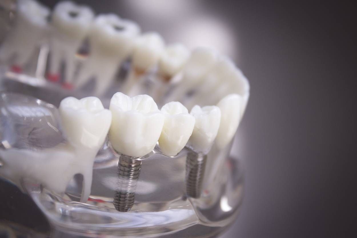 Denture for students transparent