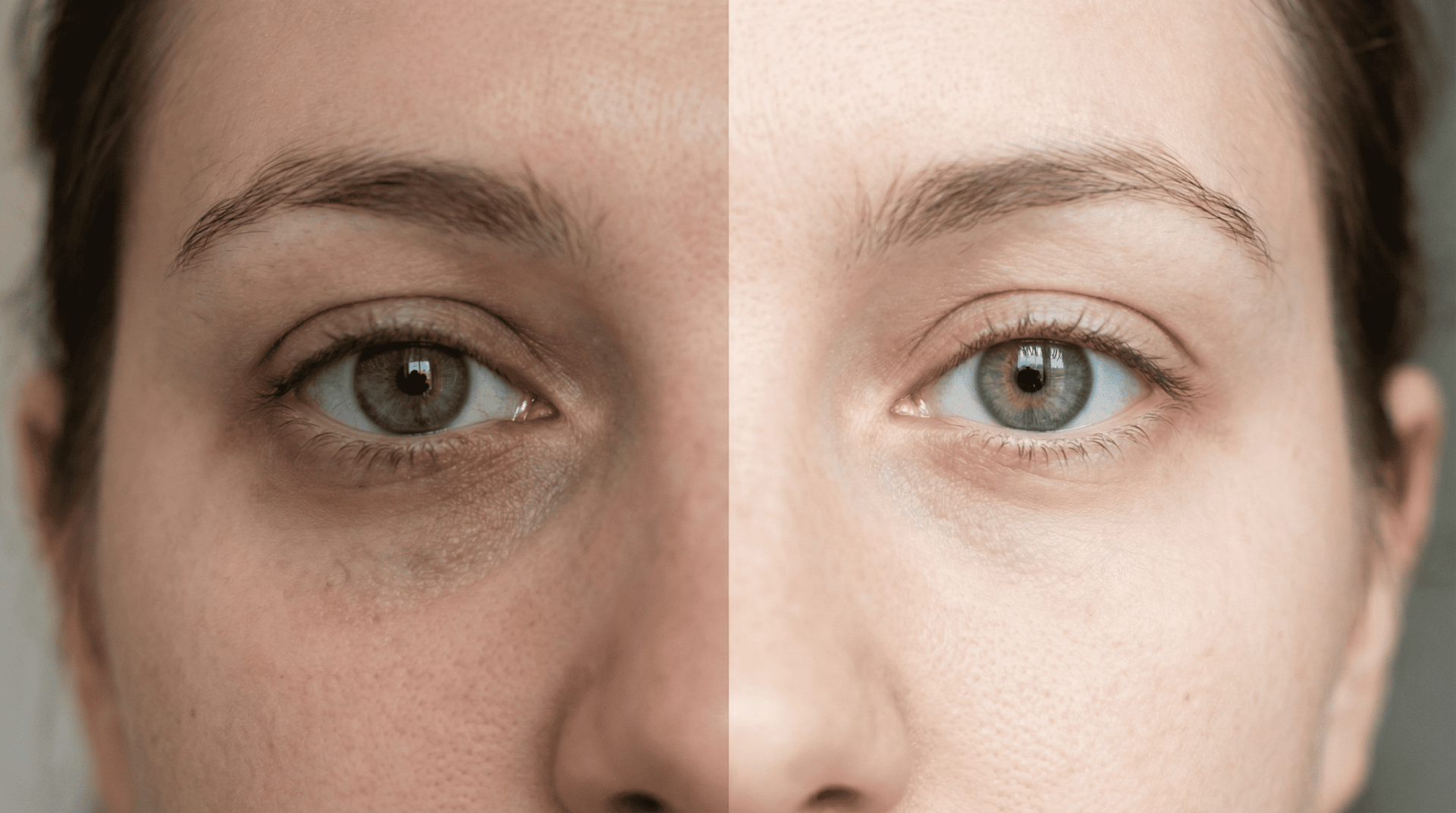 Jak poprawić oczy na zdjęciu – porównanie przed i po retuszu oczu, pokazujące rozjaśnienie cieni pod oczami i bardziej wyraziste spojrzenie